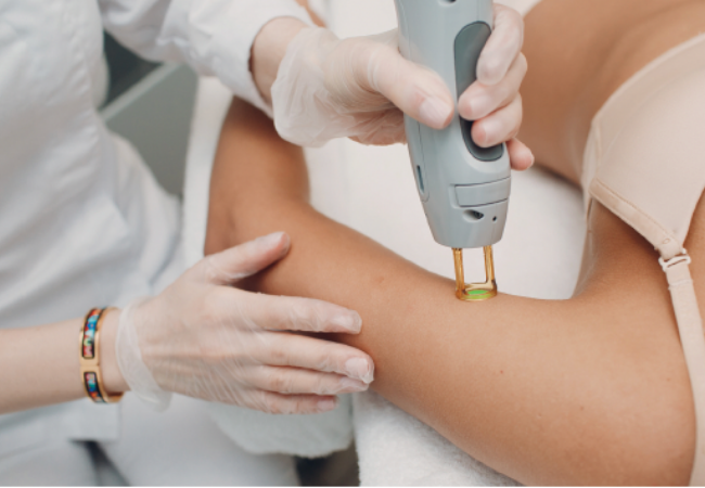 4 Reasons Laser Hair Removal is the Best Self-care Treatment